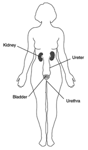 Interstitial Cystitis